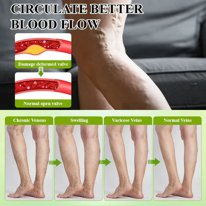 Oveallgo® CircuPro Edema & Lymphatic Support Inhaler