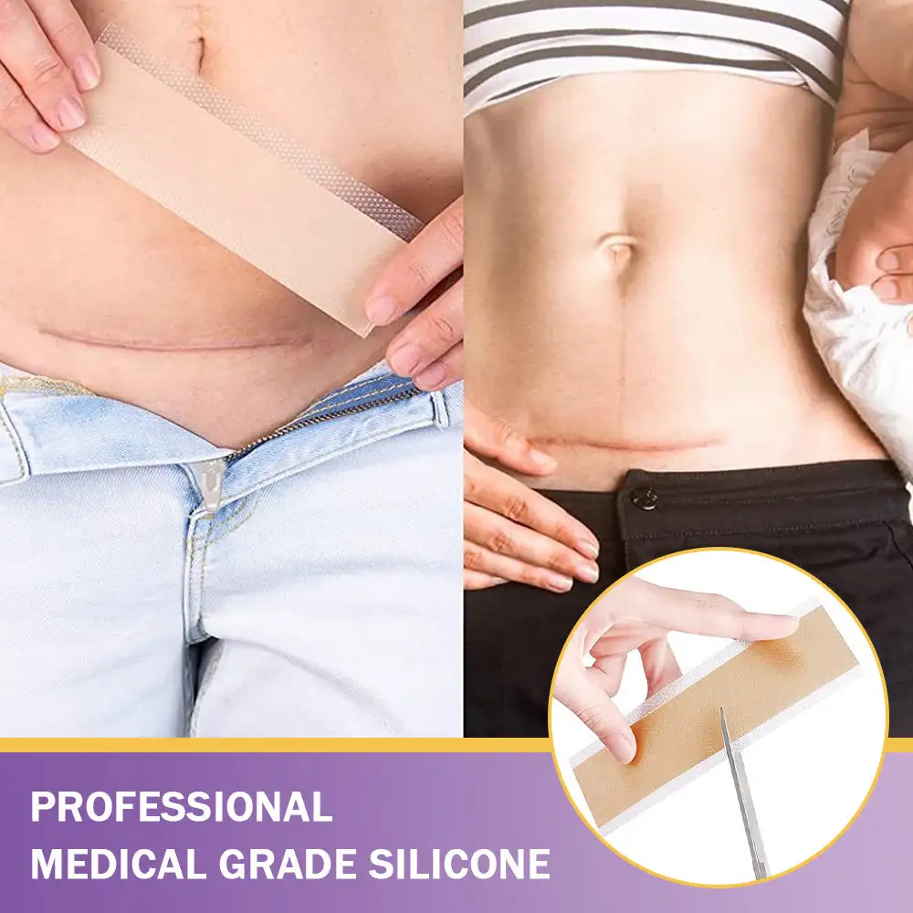 Oveallgo® Hyaluronic Acid Nano Microneedle Repair Tape