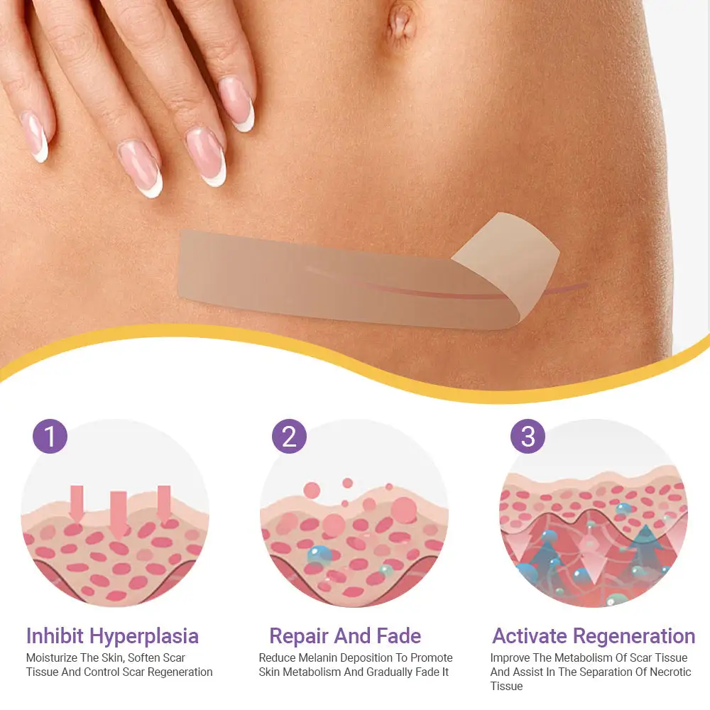 Oveallgo® Hyaluronic Acid Nano Microneedle Repair Tape