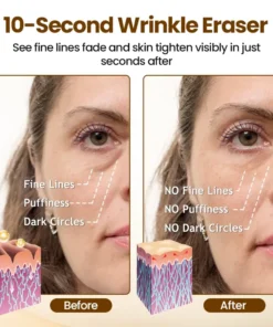 Oveallgo® Liftora 10s Wrinkle Serum