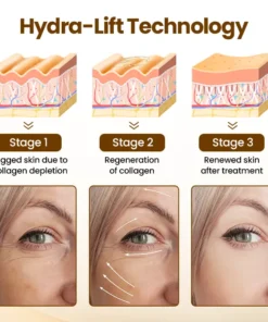 Oveallgo® Liftora 10s Wrinkle Serum