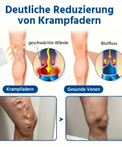 Oveallgo® 𝐕𝐞𝐢𝐧𝐓𝐚𝐫𝐠𝐞𝐭 𝐌𝐢𝐜𝐫𝐨𝐧𝐞𝐞𝐝𝐥𝐞 𝐏𝐚𝐭𝐜𝐡