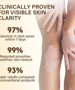 Oveallgo® VitiClear Bee Venom Cream Ultra